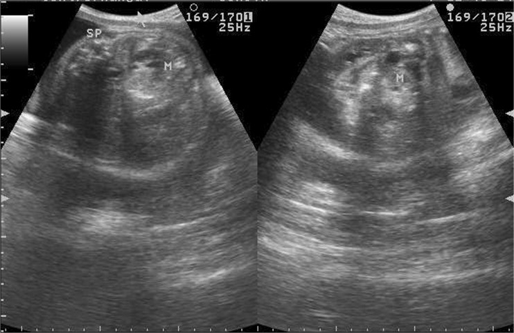 Fig.
                            1