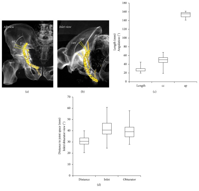 Secure Screw Placement in Management of Acetabular Fractures Using the ...