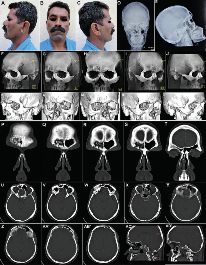 Figure 11