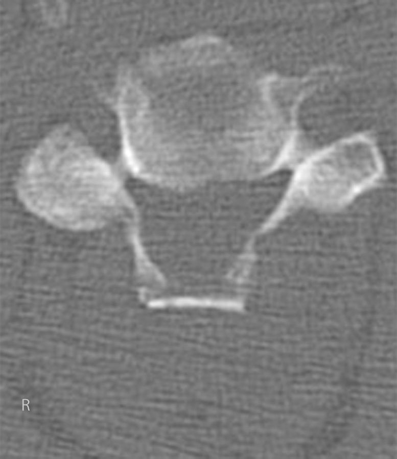 Fig. 5-B