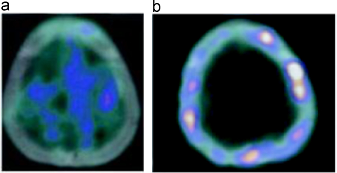 Fig. 6