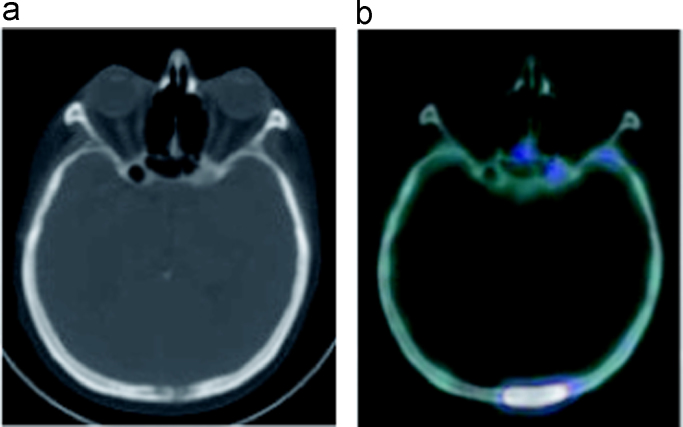 Fig. 5