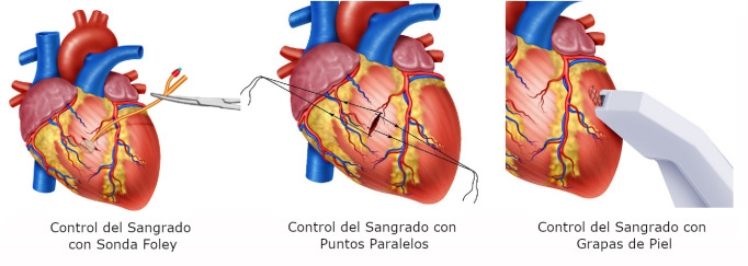 Figura 2