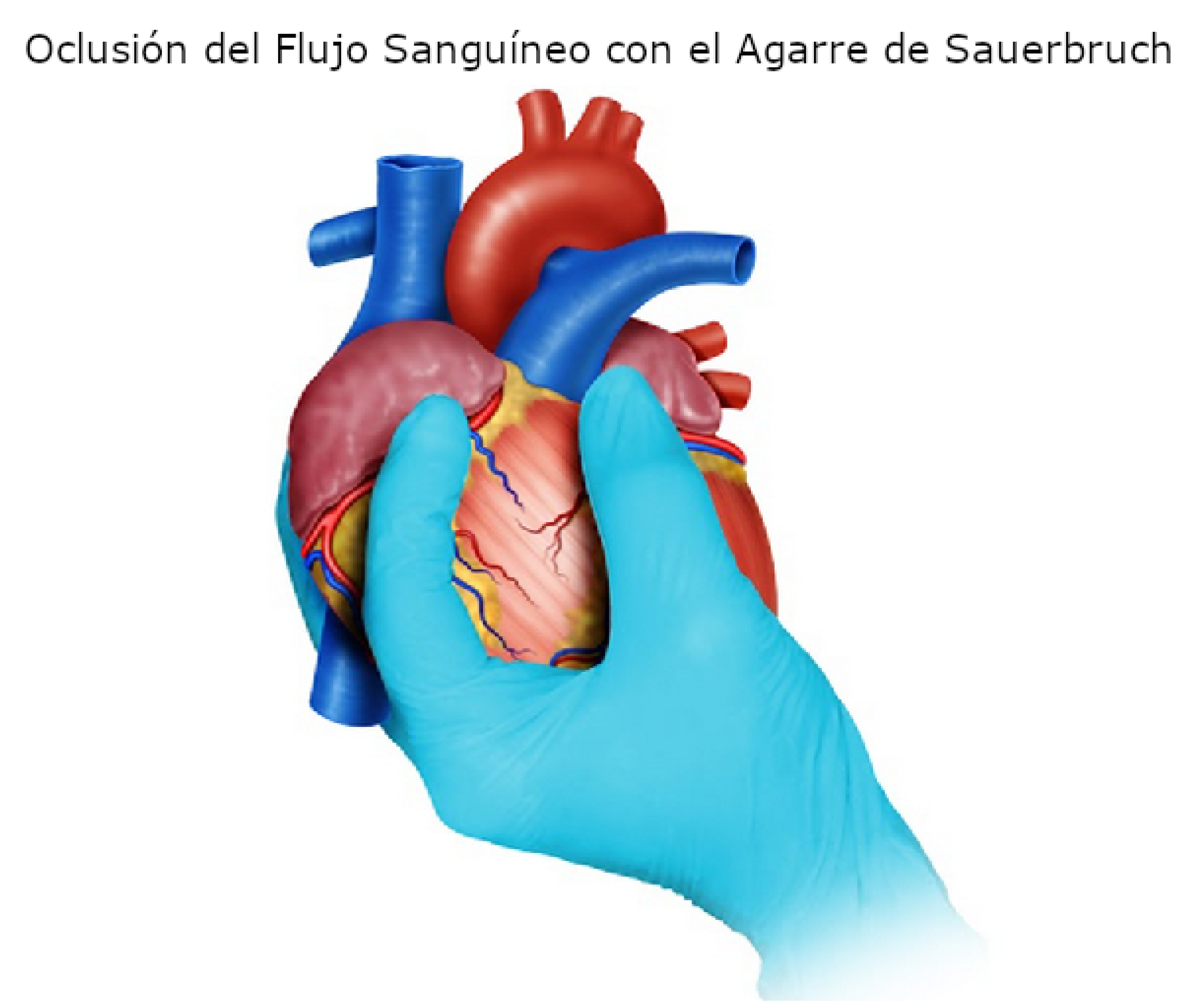 Figura 3