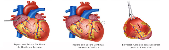 Figura 5