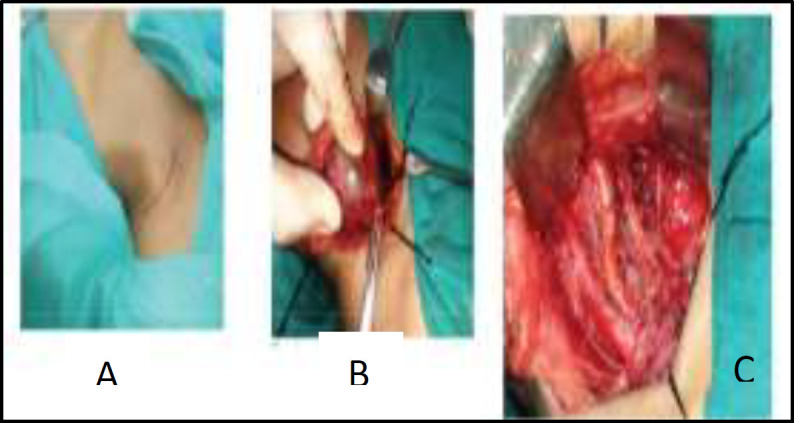 Fig 3