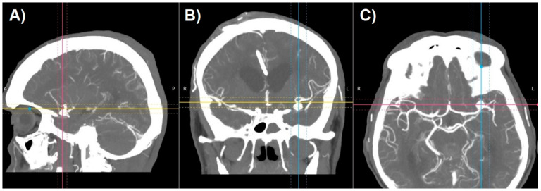 Figure 2