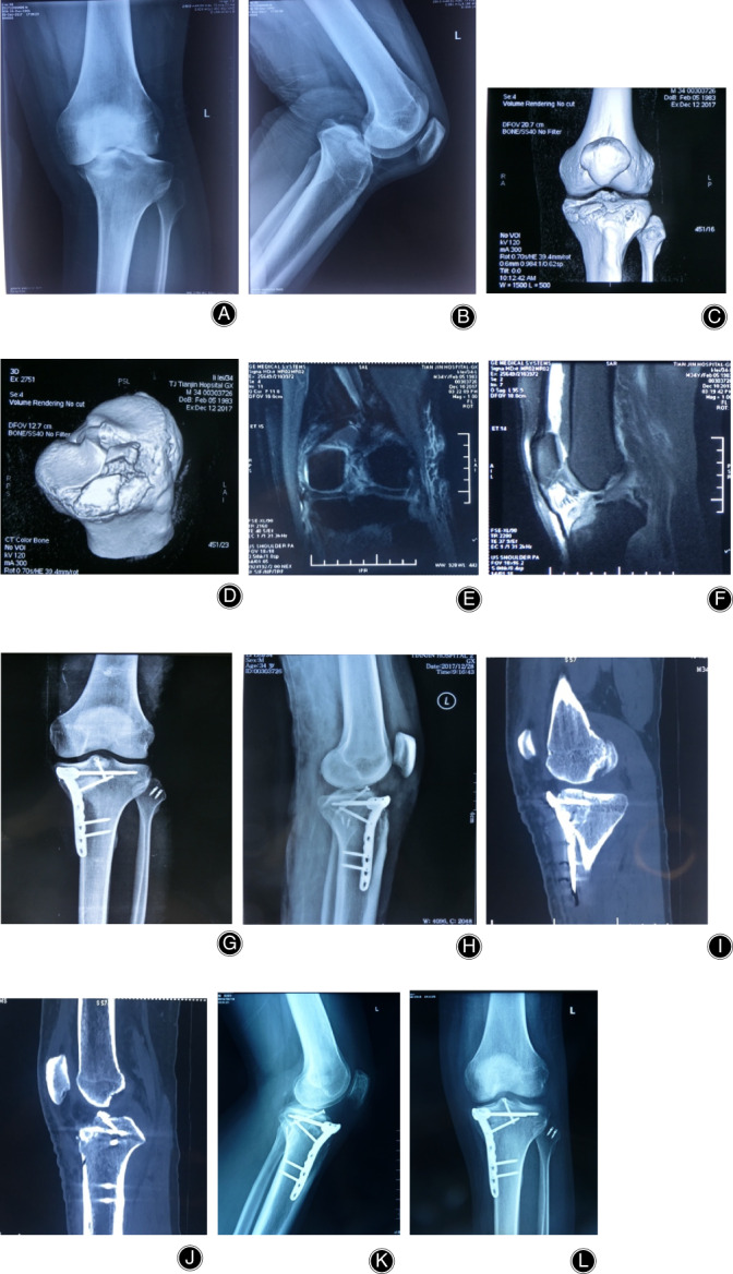 Fig 3