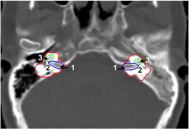 Figure 1