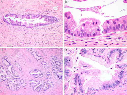 FIG. 12