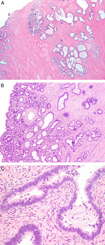 FIG. 1