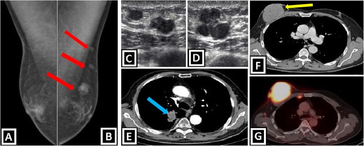 Fig. 12