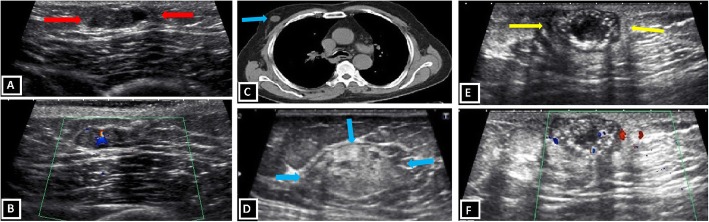 Fig. 9