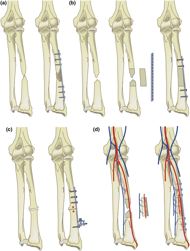 Fig. 10