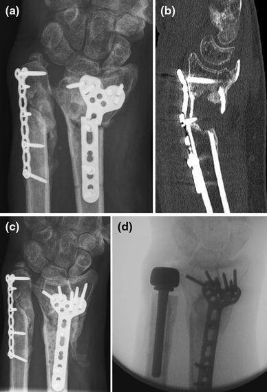 Fig. 13