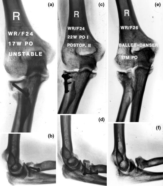 Fig. 6