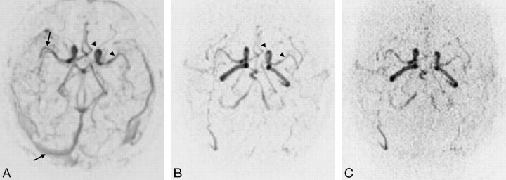 Fig 3.