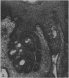 157