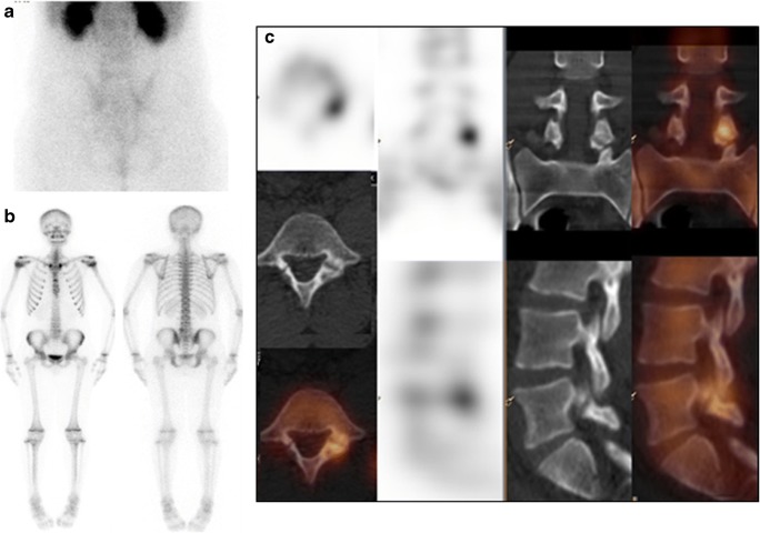 Fig. 12