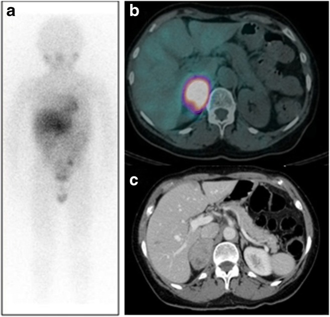 Fig. 13