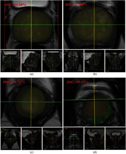 Fig. 14