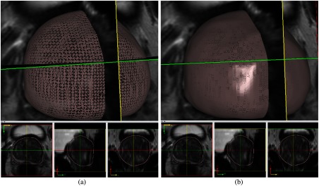 Fig. 12