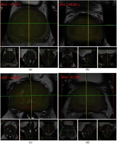 Fig. 13