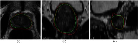 Fig. 9