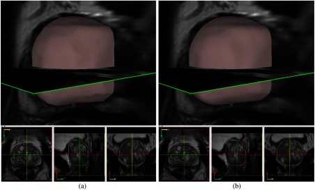 Fig. 11