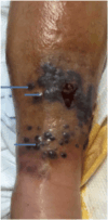 Fig. 1