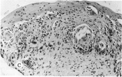 FIGURE 9 C