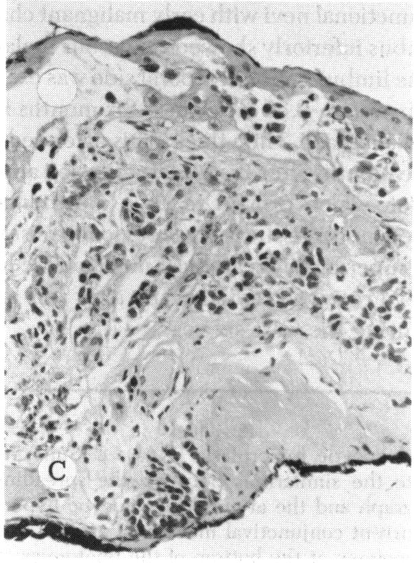 FIGURE 10 C