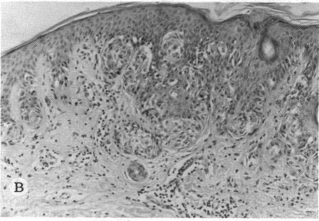 FIGURE 10 B