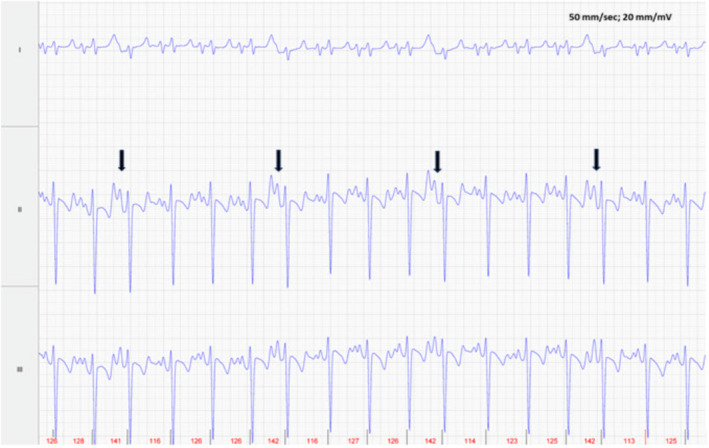 FIGURE 4