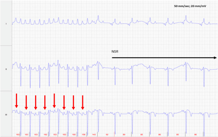 FIGURE 5