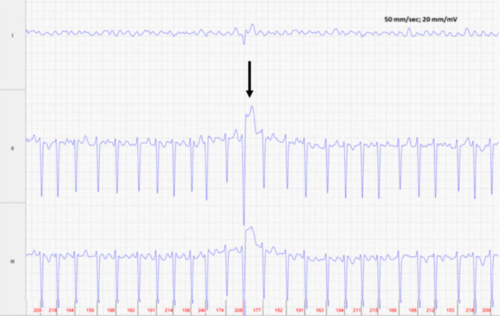 FIGURE 2