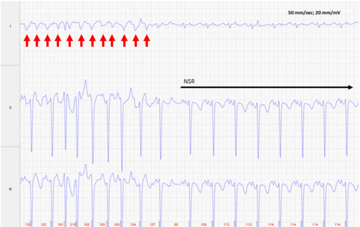 FIGURE 3