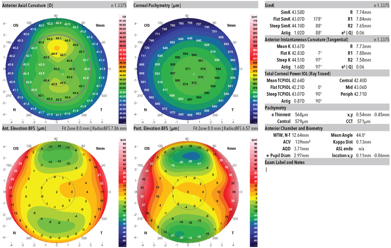 Figure 3: