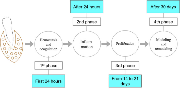 FIGURE 14