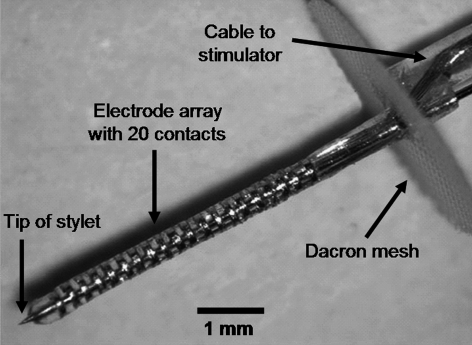 Fig. 1