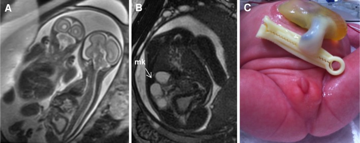 Fig. 6