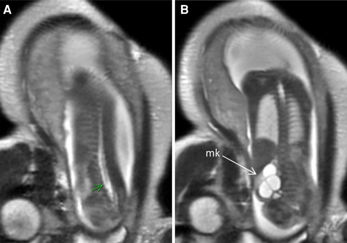 Fig. 7