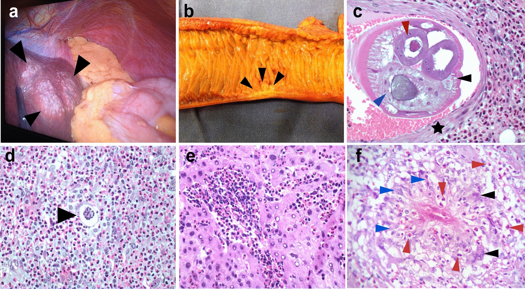 Fig. 2a–f