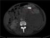 Fig 1