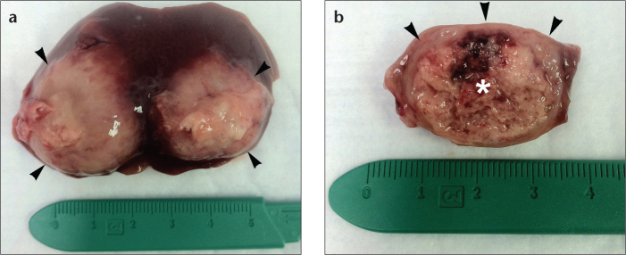 Figure 6. a, b.