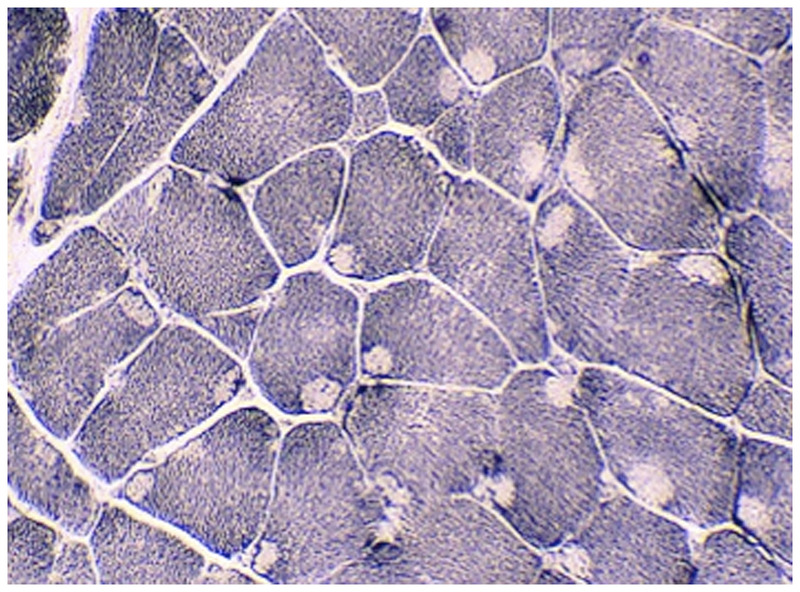 Figure 1-11.