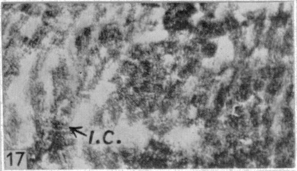 Fig. 17