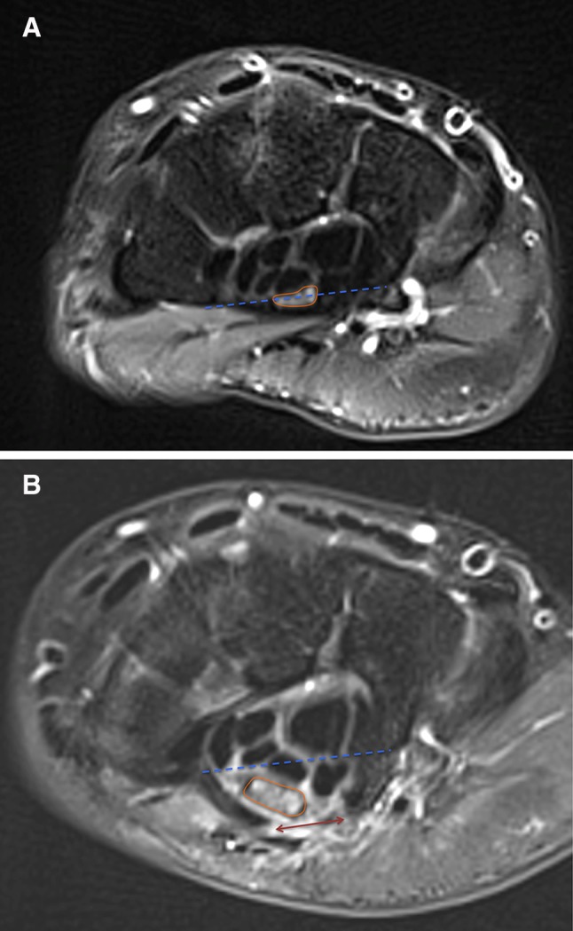 Fig. 5