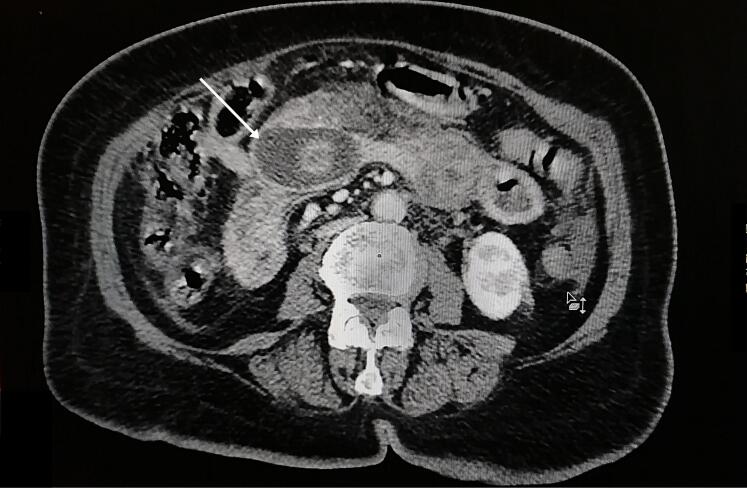 Fig. 2