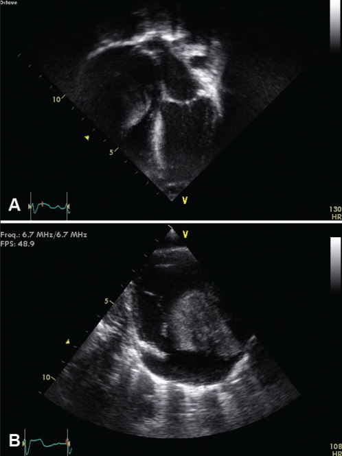 Figure 2)